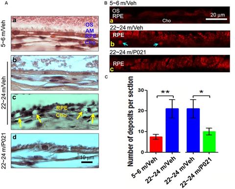 Figure 2: Chronic treatment with P021 reduces AMD-like pathology of RPE in aged rats. (A) H & E staining of RPE in the retina. AM was short or out of 