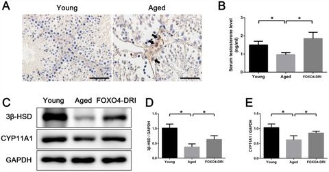 Figure 6: FOXO4-DRI alleviates testosterone secretion insufficiency in naturally aged mice. (A) Immunohistochemical staining showing that FOXO4 was ra