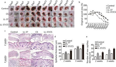 Fig. 3: LL-37/CS accelerates wound healing. a. Representative images of wounds of four tested groups, ruler units in mm. b. The results are expresse