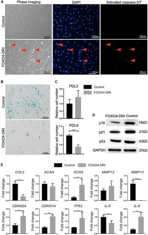FIGURE 2: Assessment of senescence level in PDL9 cells after FOXO4-DRI treatment. The samples with (FOXO4-DRI) or without (Control) FOXO4-DRI treatmen
